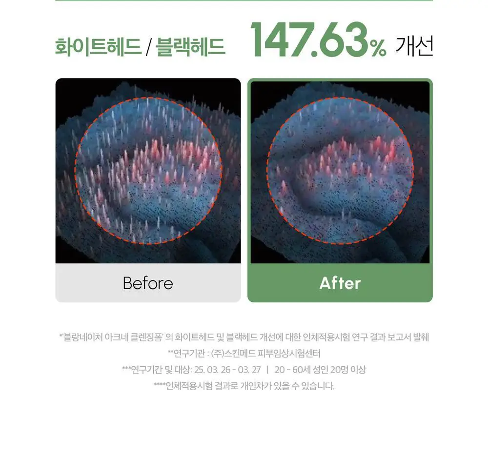 [여드름 기능성/피지케어] 블랑네이처 아크네 클렌징 폼 단품/기획 상세페이지 23